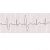Elettrocardiogramma - 9 x 27 - elaborazione informatica